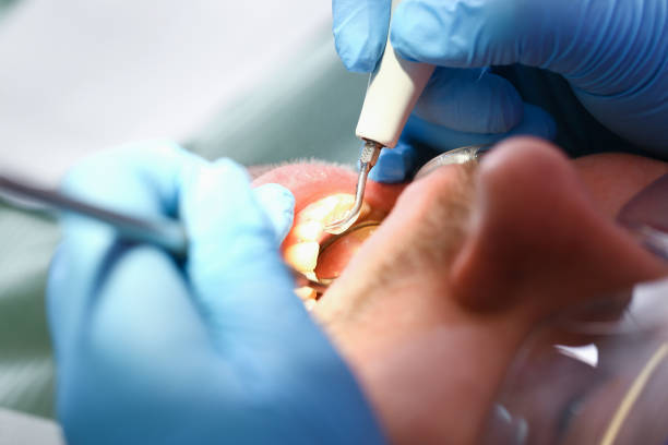 Best Weekend Emergency Dentist in Harbor Beach, MI
