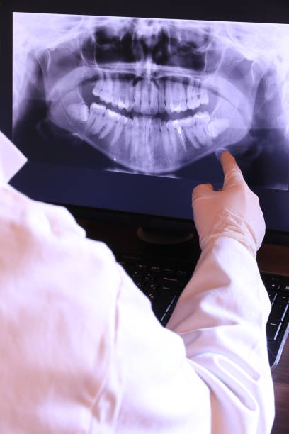 Best Emergency Dentist for Knocked-Out Tooth in Harbor Beach, MI