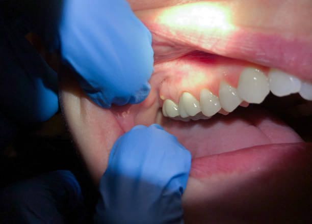 Best Emergency Dentist for Special Needs Patients in Harbor Beach, MI