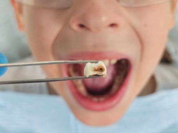 Best Emergency Dental Services for Seniors in Harbor Beach, MI